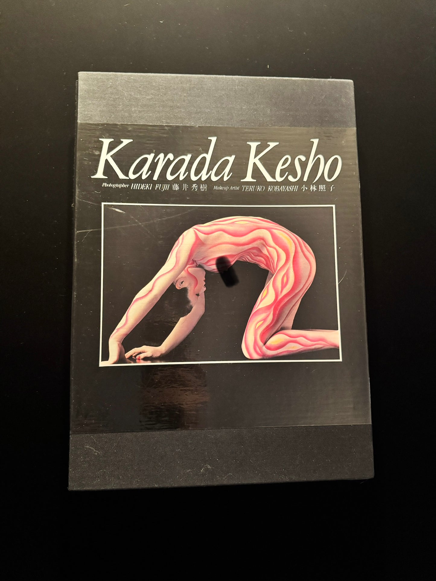 KARADA KESHO