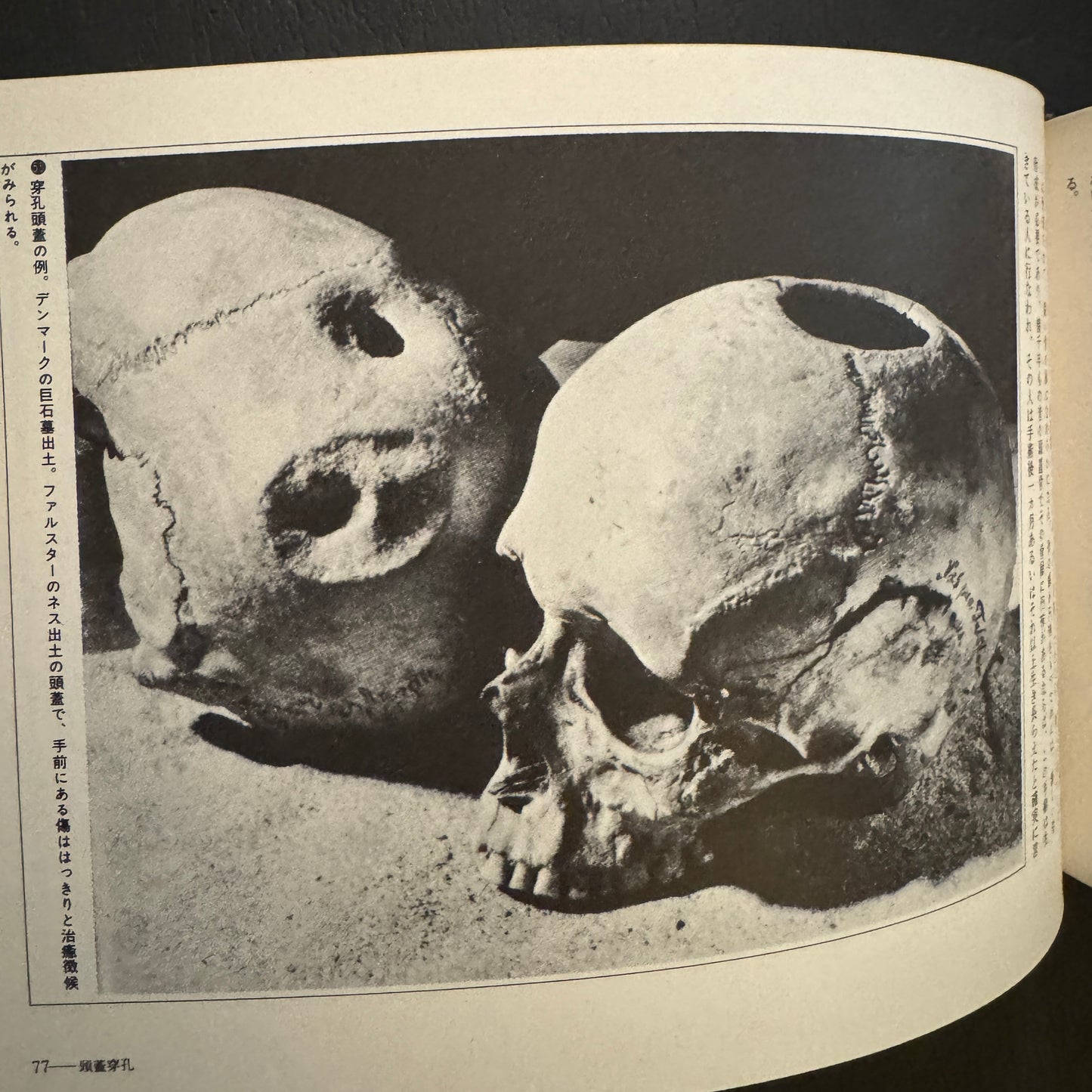 Cultural History of the Skull (Japanese edition) without a transportation carbon box